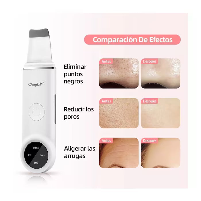 Limpiador facial ultrasónico