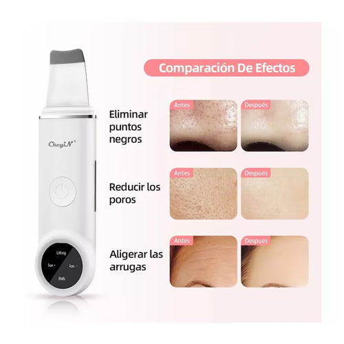 Limpiador facial ultrasónico